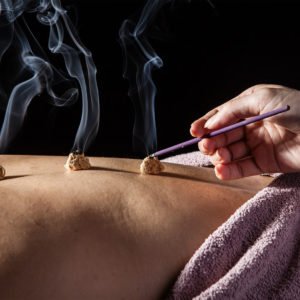 Taller de Moxibustión