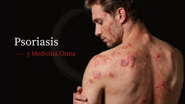 Abordaje Integrativo de la Psoriasis en MTC